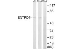 Western Blotting (WB) image for anti-Ectonucleoside Triphosphate diphosphohydrolase 1 (ENTPD1) (AA 351-400) antibody (ABIN2890296) (CD39 Antikörper  (AA 351-400))