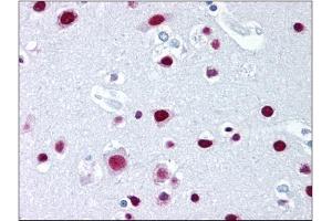 Immunohistochemistry (IHC) image for anti-Scaffold Attachment Factor B2 (SAFB2) (AA 345-357) antibody (ABIN302304) (SAFB2 Antikörper  (AA 345-357))