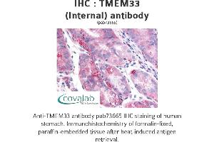 Image no. 2 for anti-Transmembrane Protein 33 (TMEM33) (Internal Region) antibody (ABIN1740155) (TMEM33 Antikörper  (Internal Region))