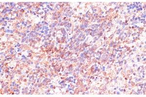 Immunohistochemistry of paraffin-embedded Rat spleen using CDC20 Polyclonal Antibody at dilution of 1:100 (40x lens). (CDC20 Antikörper)
