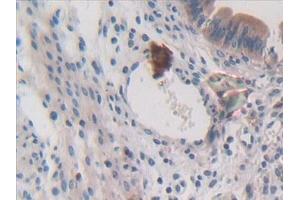 Immunohistochemistry (IHC) image for anti-Colony Stimulating Factor 1 (Macrophage) (CSF1) (AA 33-204) antibody (ABIN7430927)