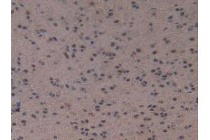 IHC-P analysis of Mouse Brain Tissue, with DAB staining. (NPPC Antikörper  (AA 30-126))
