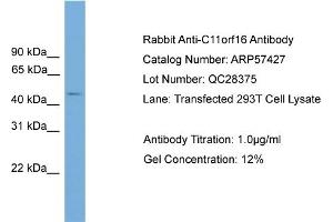 WB Suggested Anti-C11orf16  Antibody Titration: 0. (C11ORF16 Antikörper  (Middle Region))
