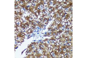 Immunohistochemistry (IHC) image for anti-G-Rich RNA Sequence Binding Factor 1 (GRSF1) antibody (ABIN7267319)
