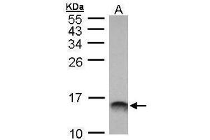 WB Image Sample (30 ug of whole cell lysate) A: Molt-4 , 15% SDS PAGE antibody diluted at 1:1000 (MIF Antikörper)