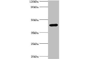 Western blot All lanes: Interleukin-1 receptor type 2 antibody at 3 μg/mL + Mouse kidney tissue Secondary Goat polyclonal to rabbit IgG at 1/10000 dilution Predicted band size: 46, 34 kDa Observed band size: 46 kDa (IL1R2 Antikörper  (AA 20-320))