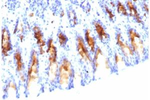 Immunohistochemistry (IHC) image for anti-Mucin 5AC, Oligomeric Mucus/gel-Forming (MUC5AC) antibody (ABIN6940128)
