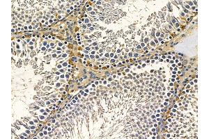 ABIN7097176 and ABIN7101244 at 1/100 staining rat testis tissue by IHC-P. (AP1S2 Antikörper)