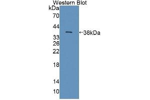 Western blot analysis of the recombinant protein. (NKp44/NCR2 Antikörper  (AA 22-120))