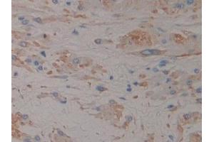 Immunohistochemistry (IHC) image for anti-Pro-Atrial Natriuretic Peptide (PRO-ANP) (AA 25-123) antibody (ABIN7431869)