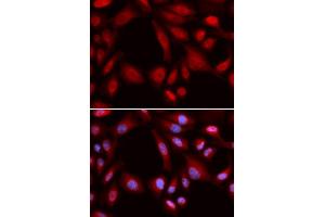 Immunofluorescence (IF) image for anti-Proteasome (Prosome, Macropain) 26S Subunit, Non-ATPase, 7 (PSMD7) antibody (ABIN1876544) (PSMD7 Antikörper)