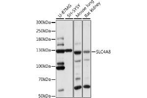 Western blot analysis of extracts of various cell lines, using SLC4 antibody (ABIN7270460) at 1:1000 dilution.
