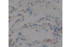 IHC-P analysis of Human Tissue, with DAB staining. (IL1F9 Antikörper  (AA 1-162))