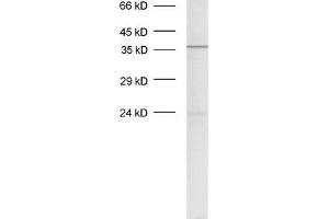 dilution: 1 : 500, sample: crude synaptosomal fraction of rat brain (P2) (Syntaxin 12/13 (AA 1-250), (Cytoplasmic Domain) Antikörper)
