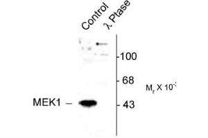 Image no. 2 for anti-Mitogen-Activated Protein Kinase Kinase 1 (MAP2K1) (pThr386) antibody (ABIN221148) (MEK1 Antikörper  (pThr386))