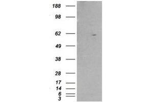 Image no. 1 for anti-Retinoid X Receptor, beta (RXRB) (Internal Region) antibody (ABIN374478) (Retinoid X Receptor beta Antikörper  (Internal Region))