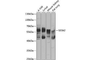 Western blot analysis of extracts of various cell lines, using SESN2 antibody (ABIN6128761, ABIN6147624, ABIN6147626 and ABIN6223421) at 1:1000 dilution. (Sestrin 2 Antikörper  (AA 211-480))