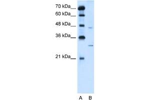WB Suggested Anti-SLC36A3 Antibody Titration:  5. (SLC36A3 Antikörper  (N-Term))