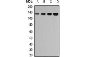 Western blot analysis of TPP2 expression in Jurkat (A), SW620 (B), mouse brain (C), mouse spleen (D) whole cell lysates. (Tpp2 Antikörper)