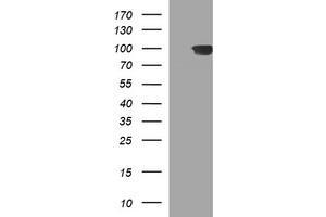 Western Blotting (WB) image for anti-ADAM Metallopeptidase with thrombospondin Type 1 Motif, 8 (ADAMTS8) antibody (ABIN1496471)