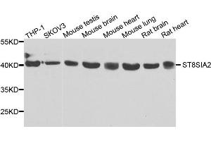 Western blot analysis of extracts of various cells, using ST8SIA2 antibody. (ST8SIA2 Antikörper)