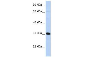 PADI4 antibody used at 1 ug/ml to detect target protein. (PAD4 Antikörper  (Middle Region))