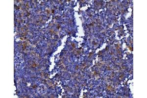 IHC analysis of MSF/SEPTIN9 using anti-MSF/SEPTIN9 antibody (ABIN7600104). (Septin 9 Antikörper  (AA 15-282))