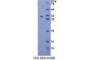 SDS-PAGE analysis of Human PGAM2 Protein. (PGAM2 Protein)
