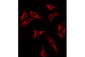 ABIN6272417 staining HeLa by IF/ICC. (RPS2 Antikörper  (C-Term))
