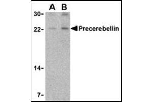 Western blot analysis of precerebellin in mouse cerebellum lysate with this product at (A) 2 and (B) 4 μg/ml. (CBLN1 Antikörper  (Center))