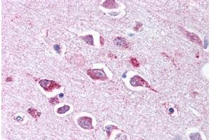 Anti-TLL2 antibody  ABIN1049410 IHC staining of human brain, neurons and glia. (Tolloid-Like 2 Antikörper  (CUB2 Domain))