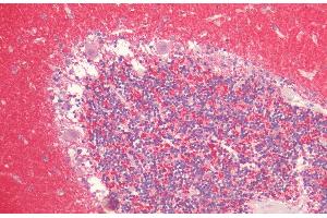 Immunohistochemistry analysis using Rabbit Anti-Alpha Synuclein Polyclonal Antibody (ABIN6698745). (SNCA Antikörper  (HRP))