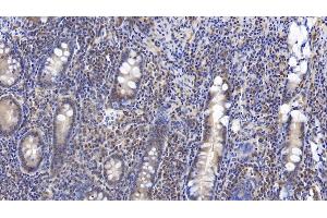 Detection of VF in Human Small intestine Tissue using Monoclonal Antibody to Visfatin (VF)