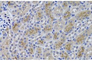 Immunohistochemistry of paraffin-embedded Mouse kidney using GGT1 Polyclonal Antibody at dilution of 1:100 (40x lens). (GGT1 Antikörper)