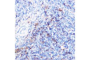 Immunohistochemistry of paraffin-embedded mouse spleen using CD40 Rabbit pAb (ABIN3020703, ABIN3020704, ABIN3020705 and ABIN6213680) at dilution of 1:100 (40x lens). (CD40 Antikörper)