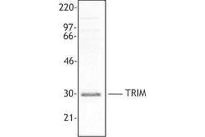 Western Blotting (WB) image for anti-T Cell Receptor Associated Transmembrane Adaptor 1 (TRAT1) (AA 29-186) antibody (ABIN2666376)
