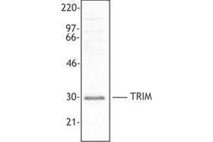 Western Blotting (WB) image for anti-T Cell Receptor Associated Transmembrane Adaptor 1 (TRAT1) (AA 29-186) antibody (ABIN2666376) (TRIM Antikörper  (AA 29-186))