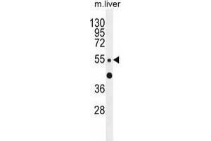 ZNF672 Antibody (C-term) western blot analysis in mouse liver tissue lysates (35 µg/lane). (ZNF672 Antikörper  (C-Term))