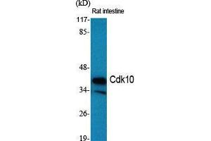 Western Blot (WB) analysis of specific cells using Cdk10 Polyclonal Antibody.