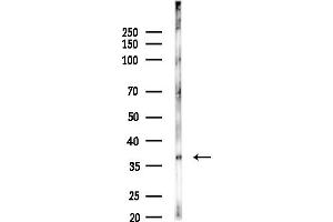 Western blot analysis of lysates from COLO205 cells, using WNB Antibody at 1/1000 dilution.