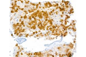 Immunohistochemistry (IHC) image for anti-Lymphocyte Antigen 6 Complex, Locus G (Ly6g) antibody (ABIN7448893) (Ly6g Antikörper)