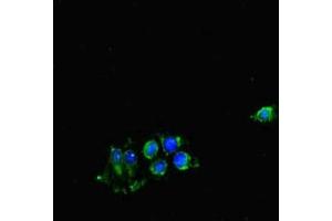 Immunofluorescent analysis of Hela cells using ABIN7148902 at dilution of 1:100 and Alexa Fluor 488-congugated AffiniPure Goat Anti-Rabbit IgG(H+L) (CDK7 Antikörper  (AA 212-341))