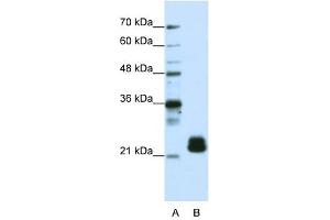 TMED4 antibody used at 1. (TMED4 Antikörper  (N-Term))