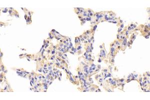 Immunohistochemistry (IHC) image for anti-Toll-Like Receptor 5 (TLR5) (AA 303-514) antibody (ABIN7438082)