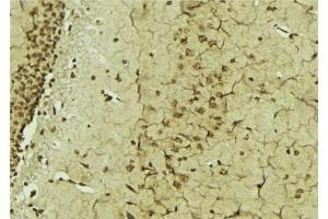 ABIN6276833 at 1/100 staining Mouse brain tissue by IHC-P.