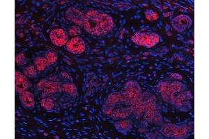 IF analysis of IMPDH2 using anti-IMPDH2 antibody (ABIN7603063).