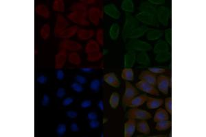 ABIN6258372 and ABIN6275122 staining Hela cells(30 min of UV treatment) by IF/ICC.