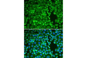 Immunofluorescence analysis of A549 cells using IDE antibody (ABIN5970800). (IDE Antikörper)