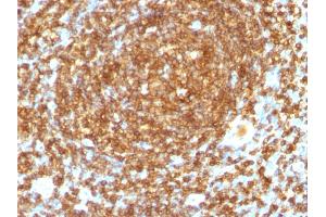Formalin-fixed, paraffin-embedded human Tonsil stained with CD45RB Monoclonal Antibody (PTPRC/1132). (CD45 Antikörper)