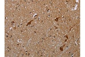 The image is immunohistochemistry of paraffin-embedded human brain tissue using ABIN7190062(CASP8AP2 Antibody) at dilution 1/20. (FLASH Antikörper)